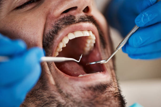 Best Emergency Treatment for Dental Infections or Abscesses in Seco Mines, TX