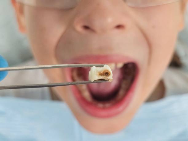 Best After-Hours Dental Trauma Care in Seco Mines, TX